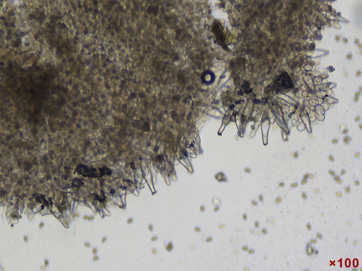 Cheilocystides