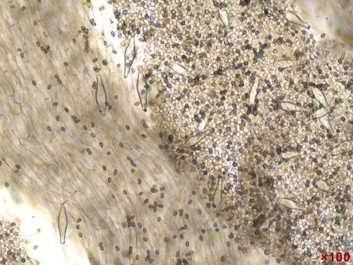 Pleurocystides
