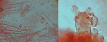 Hyphes cuticule et baside.JPG