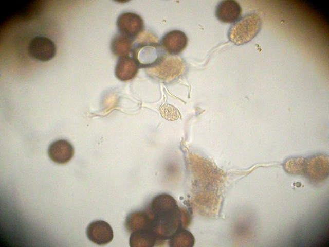 Badhamia-spores et capillitium_220113c.JPG