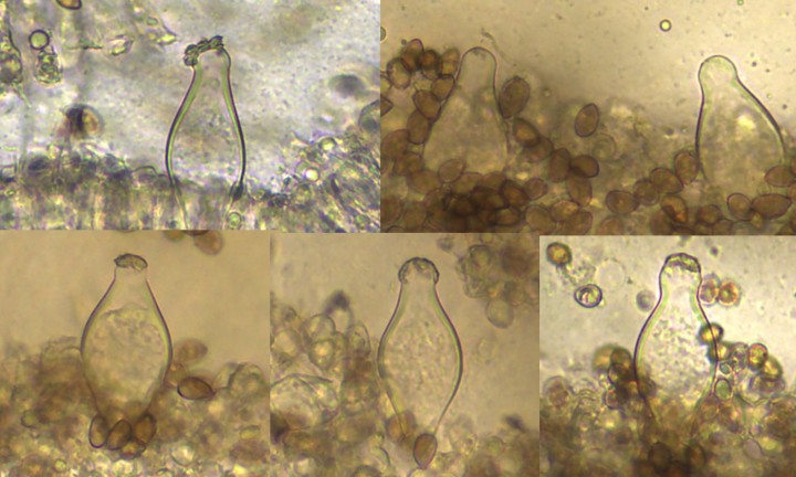 Pleurocystides x400
