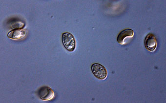 spore d'hébélome.jpg