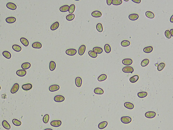 spores_x400.jpg