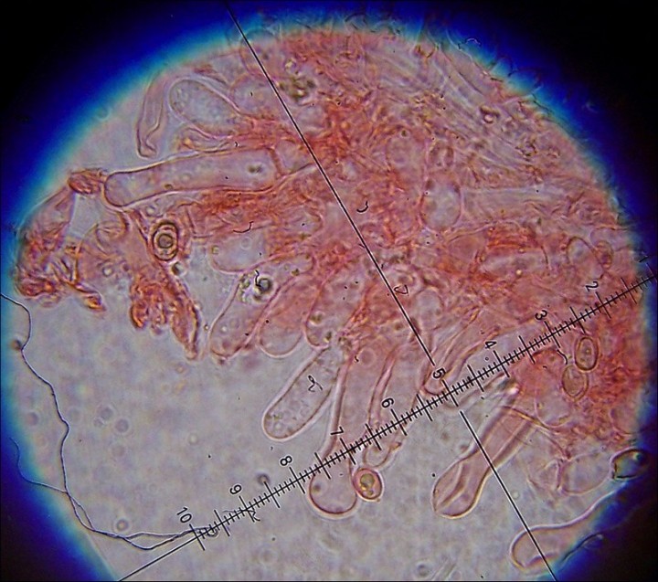 Cheilocystides