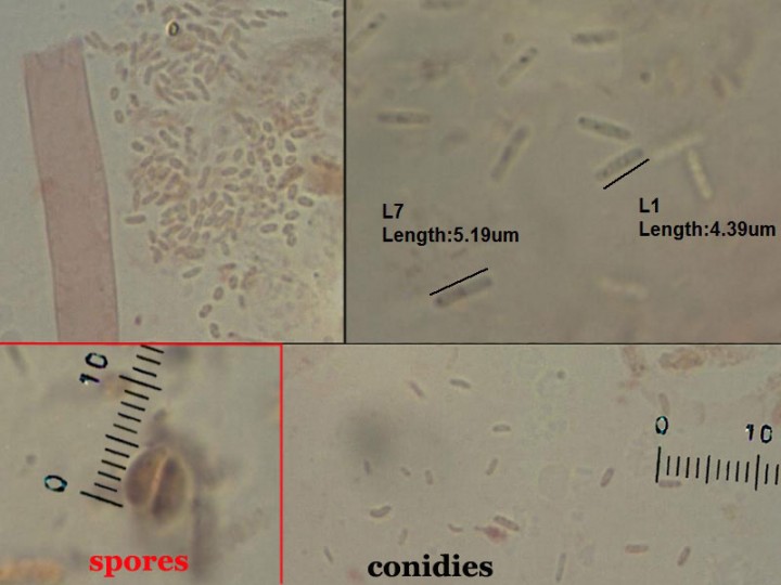 conidie-spore.jpg