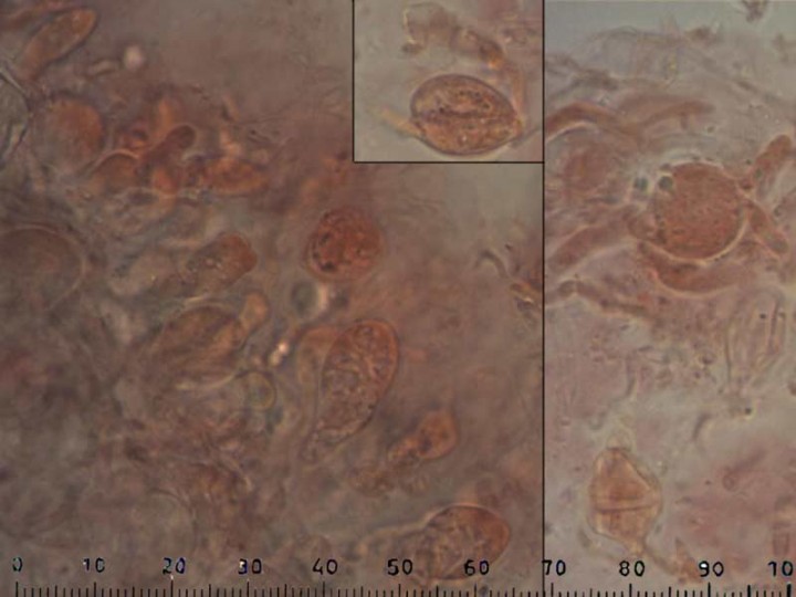 basidium.jpg