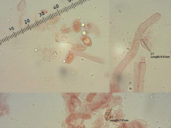 Clitocybe-spore.jpg