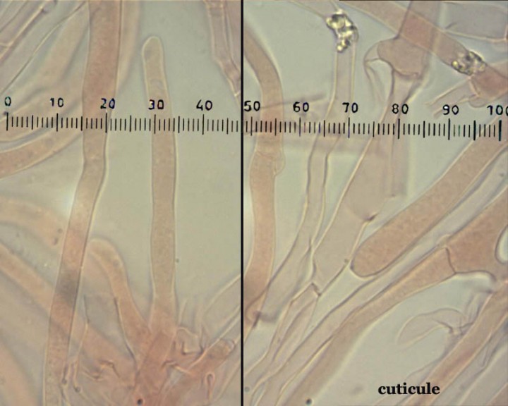 clitocybe-cuticule1.jpg