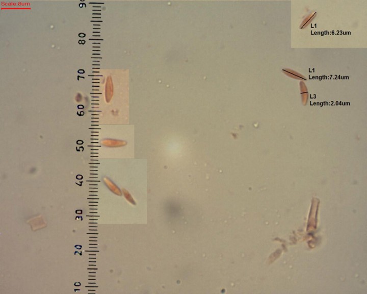 Dasyscyphus-spores.jpg