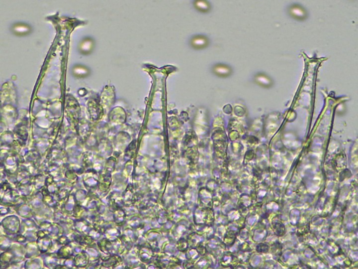 pleurocystides_x400.jpg