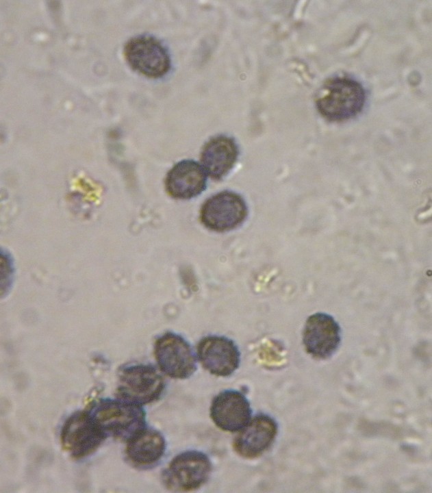 spores Leucopaxillus.jpg