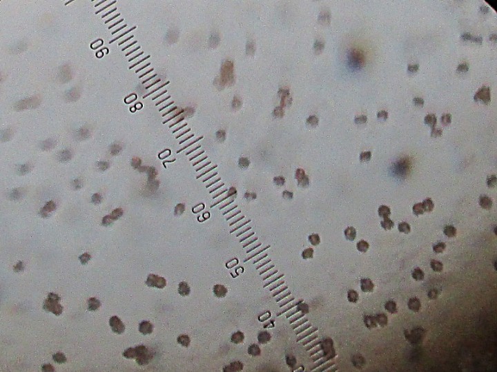 spores