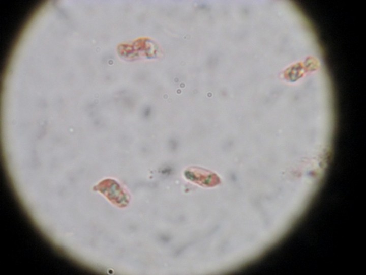 ma photo micro est merdue, veuillez m'excuser :)