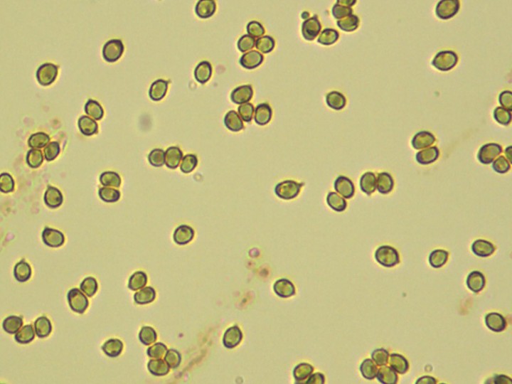spores_meltzer.jpg