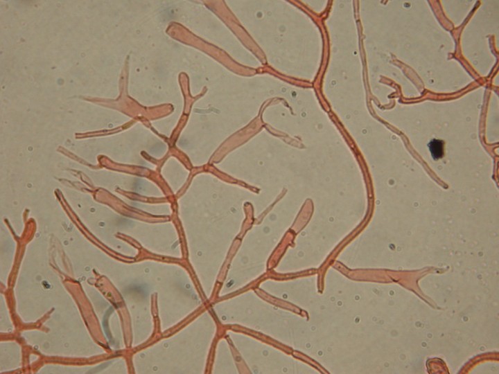 Dacrymyces capitatus   Loverval  5 Juin 2011 132.jpg