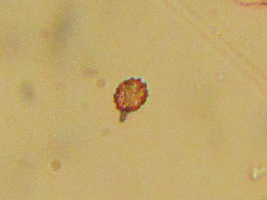 Une spore ?