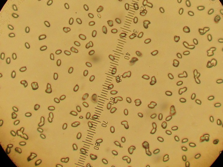 ECHELLE : 1 Div = 2,5 µm