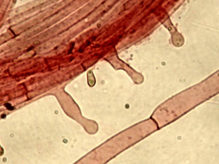 001 Caulocystides STIPE 4 déc 2015 (12)-redim1024.JPG