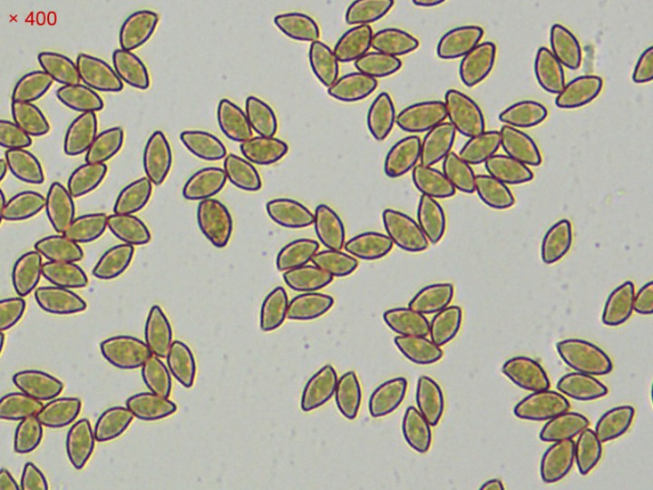 spores_x400.jpg