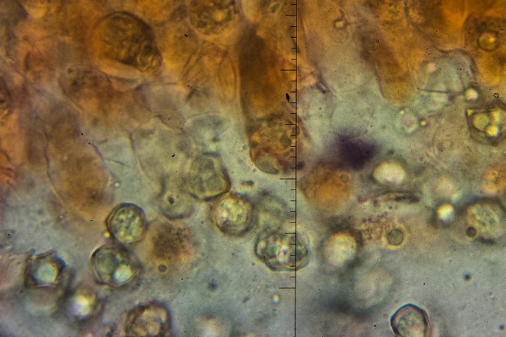Spores et cystides.JPG