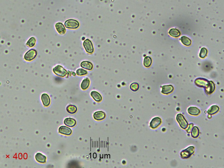 spores_Meltzer_x400.jpg