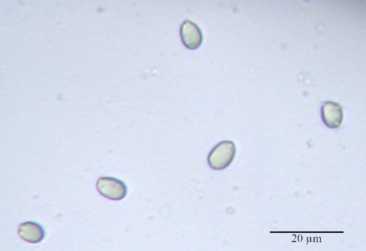 -6b-Lézignan-4 11 2017-LG.jpg