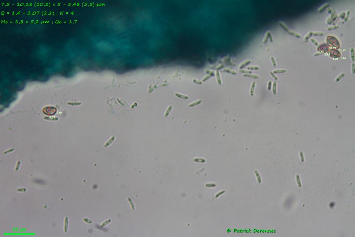 taille des spores &lt; 10 µm