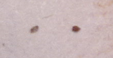 Spores.png