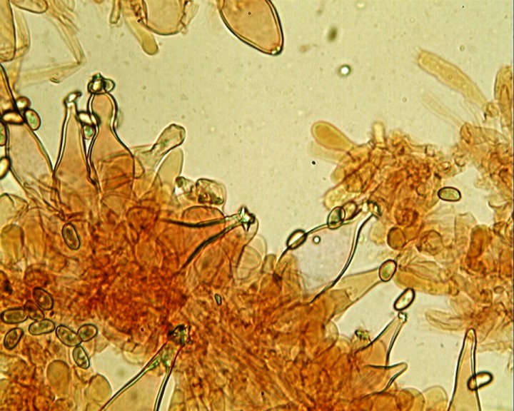 Psathyrella spadicea 40 X  cheilo (JP) micro.jpg