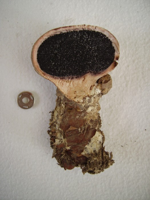 scléroderme 003.jpg