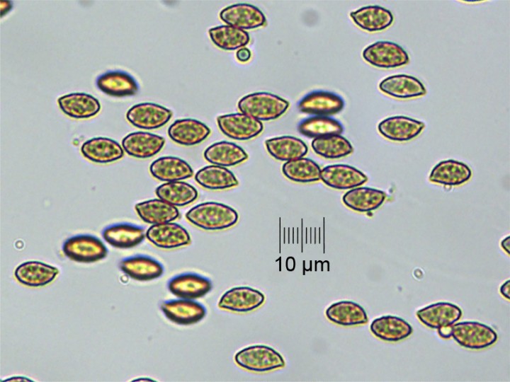 spores_x400.jpg