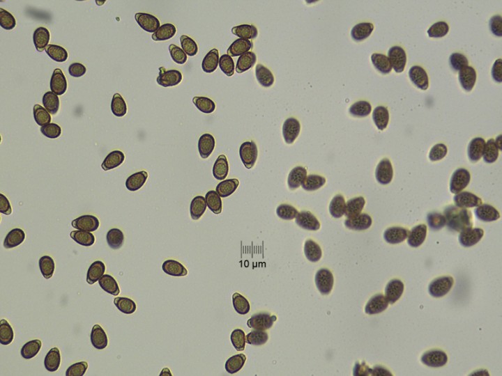 spores_x400_01.jpg