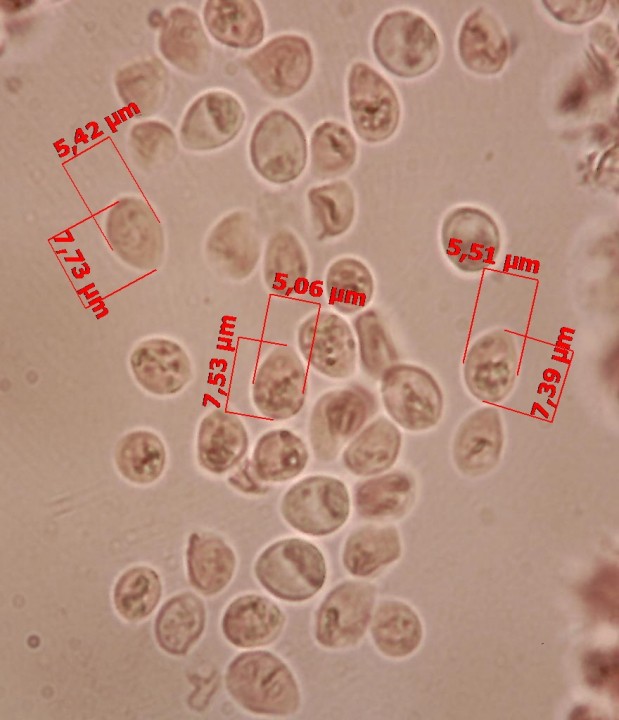 100 X spores - Copie.jpg