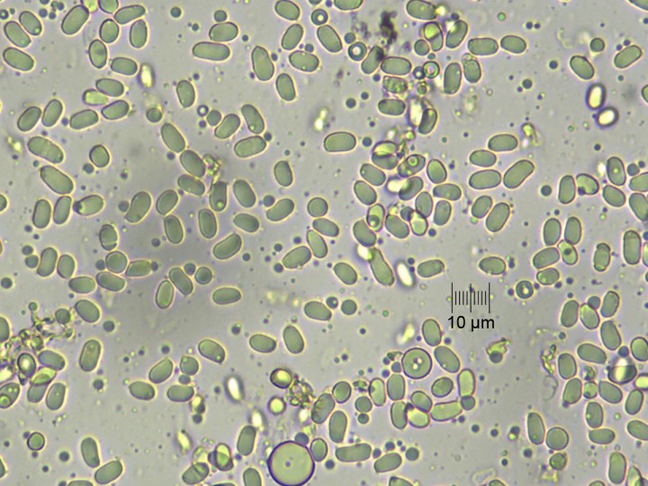 spores_Meltzer_x400.jpg