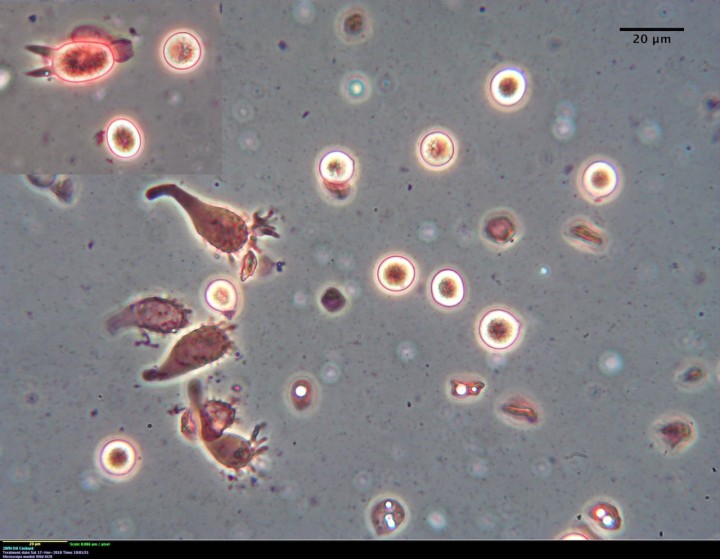 spores - copie.jpg