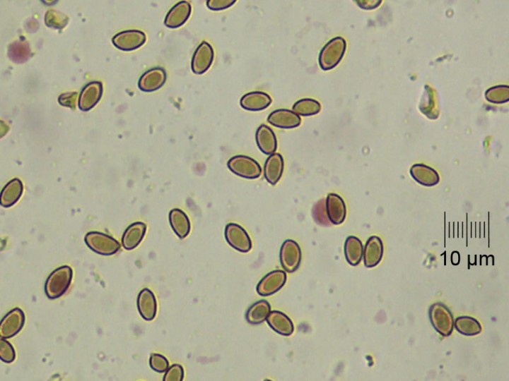 spores_x400_Meltzer.jpg