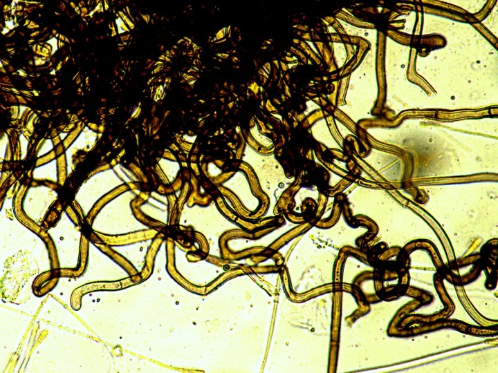 POILS DE L'EXCIPULUM