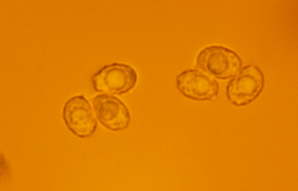 Spores dans rouge congo