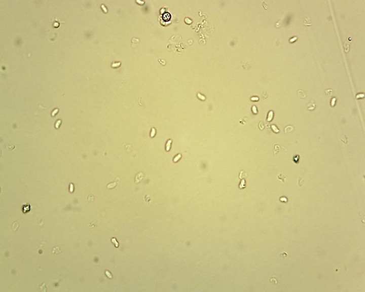 spores eau 40 X.jpg