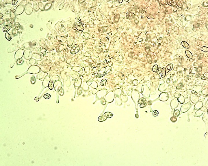 Galerina 40 X cheilo 1.jpg