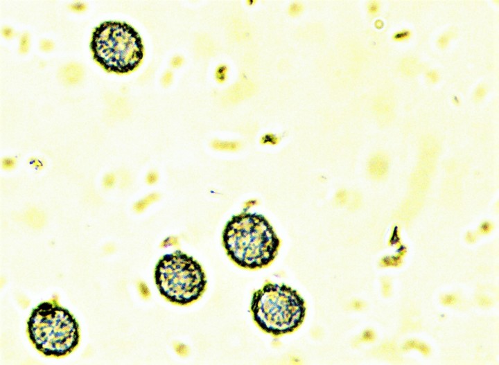 6,7-7,8 x 5,7-6,4 µ.jpg