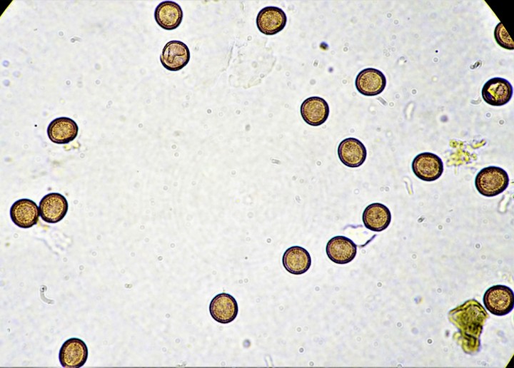 8,6-9,4 µ (1024x734).jpg