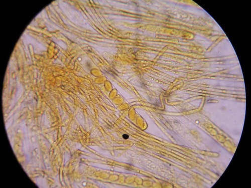 fimicole_spores.jpg