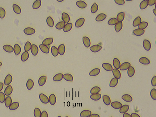 spores_x400_02.jpg