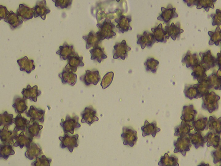 spores_x400_01.jpg