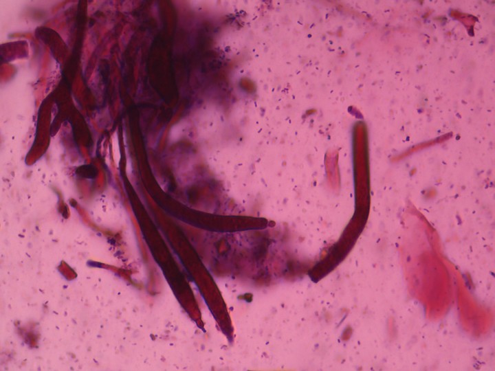 Dermatocystides