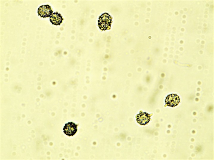 7-8,6 x 6,1-6,6 µ (1024x768).jpg