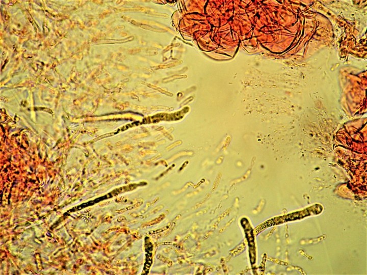 Dermatos 5à 8 µ  (1024x768).jpg