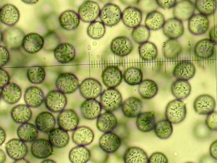 Spores_Russula_melliolens.jpg