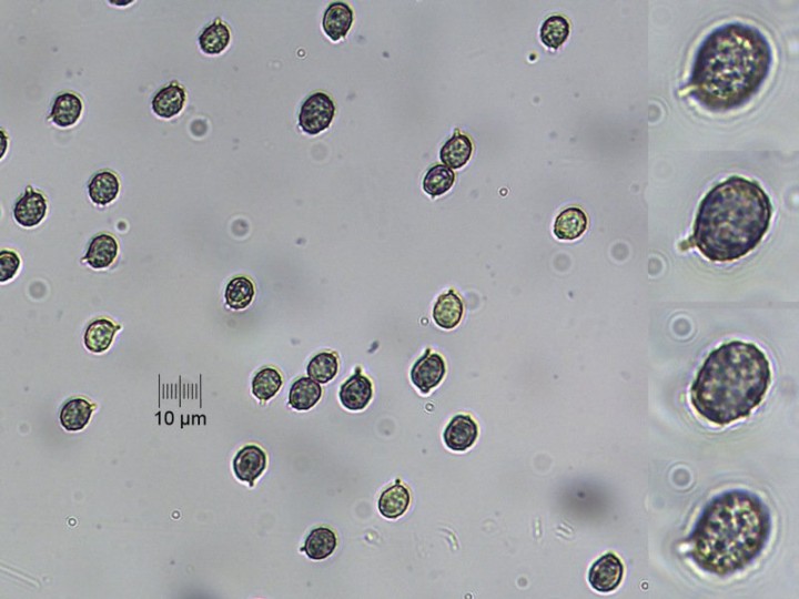 spores_x400_01.jpg